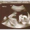Baby number 5