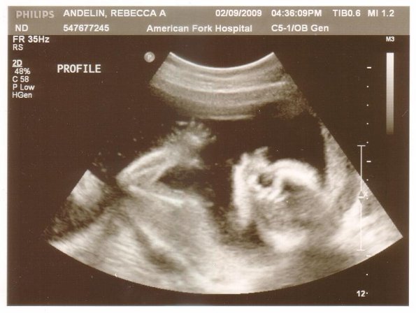 Baby number 5